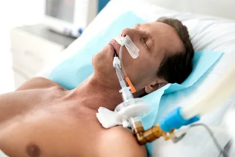 Mechanical Ventilation